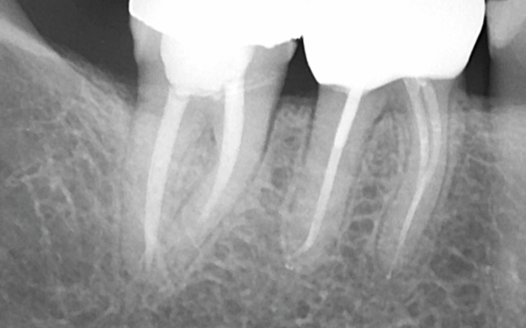 Beyond Implants: Rediscovering Our Roots