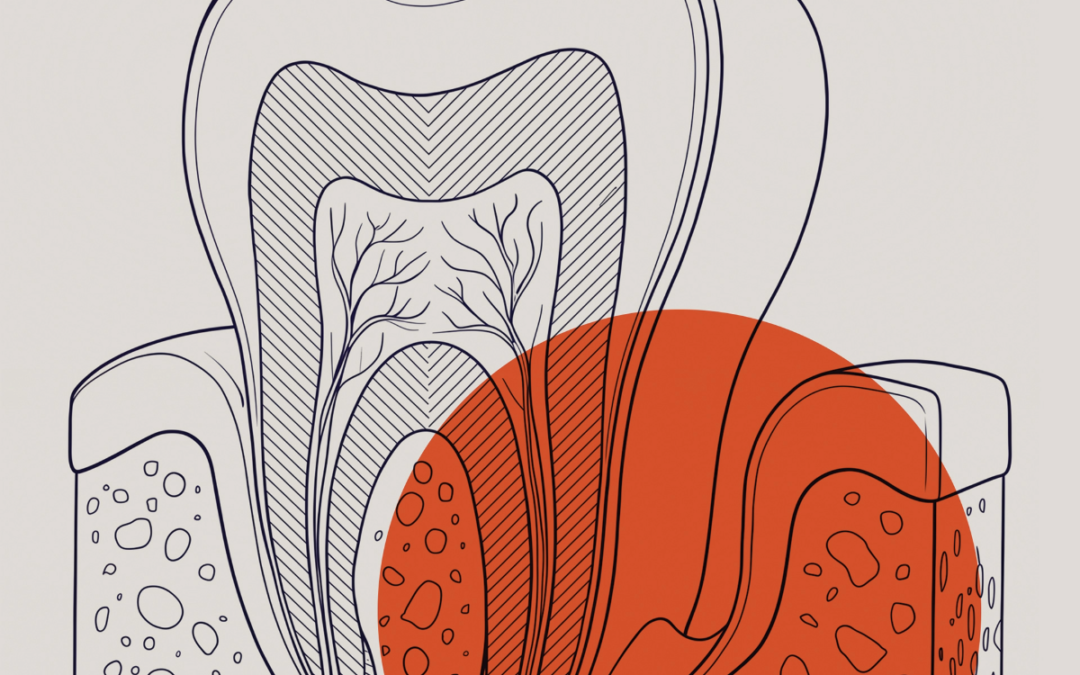 Inflammatory and Immunological Basis of Periodontal Diseases